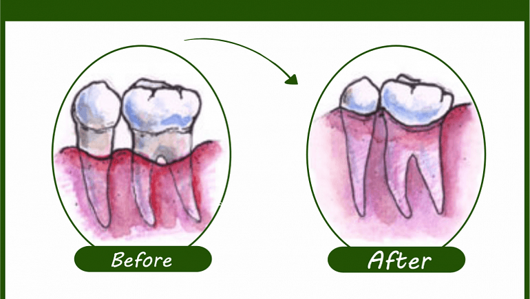 Dental-Pro-7-Transformation-768x602.png